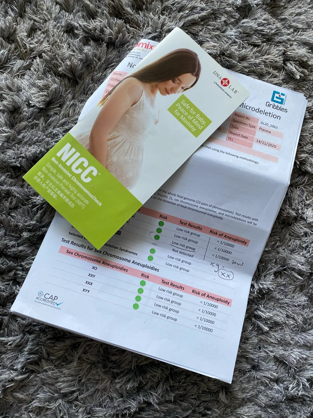 🇲🇾 来聊一聊非侵入性胎儿染色体基因检测,代孕成功率较高的医院_国内试管双胞胎